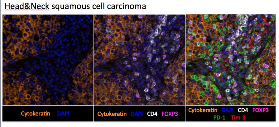 Multiplex Immunofluorescence | CIO Tissue Biomarker Lab